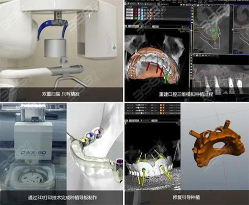 国产微创种植牙体验视频,亲身体验，见证国产牙科技术的飞跃